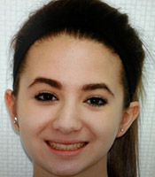 Patient3_After.jpg