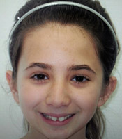 Patient3_Before.jpg
