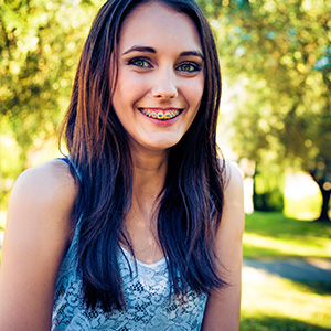 s-braces2.jpg